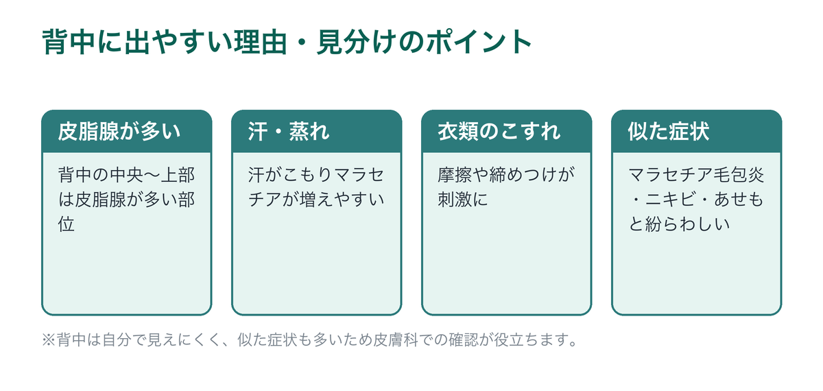 背中に脂漏性皮膚炎が出やすい理由と見分けのポイントを示した図