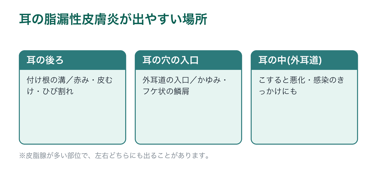 耳の脂漏性皮膚炎が出やすい場所を示した図