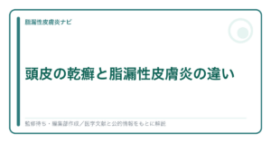 頭皮の乾癬と脂漏性皮膚炎の違いを解説する記事のアイキャッチ