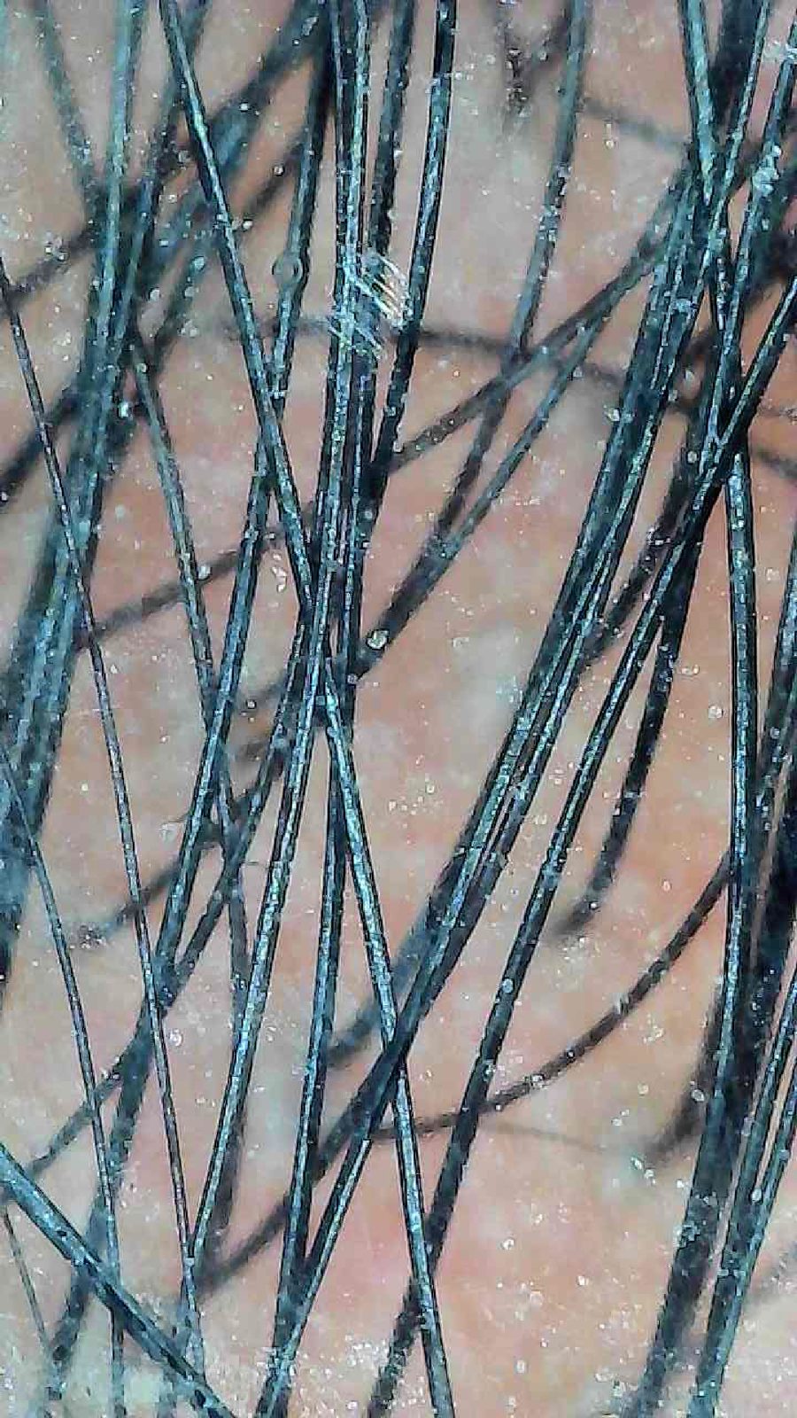 被験者001 使用前の頭皮