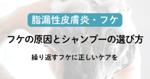 フケの原因とシャンプーの選び方｜繰り返すフケに正しいケアをのアイキャッチ画像