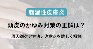 頭皮のかゆみ対策の正解は？原因別ケア方法と注意点を詳しく解説のアイキャッチ画像