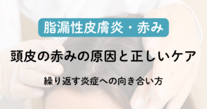 脂漏性皮膚炎ナビ関連画像