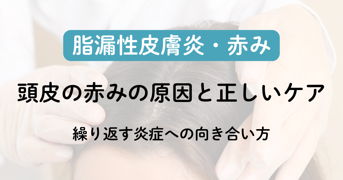 脂漏性皮膚炎ナビ関連画像